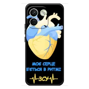 ЗСУ Чехлы (TPU) для Xiaomi Redmi Note 17 Pro Max (Ритм ЗСУ)