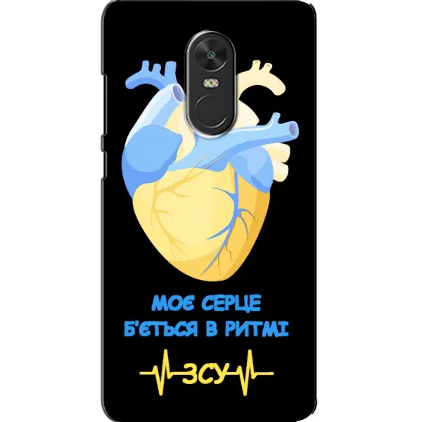 Чехол с рисунком «Ритм ЗСУ» для Xiaomi Redmi Note 4X Чехол с рисунком «Ритм ЗСУ» для Xiaomi Redmi Note 4X