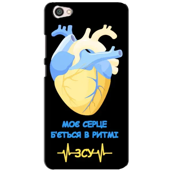 Чехол с рисунком «Ритм ЗСУ» для Xiaomi Redmi Note 5A Чехол с рисунком «Ритм ЗСУ» для Xiaomi Redmi Note 5A