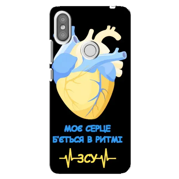 Чехол с рисунком «Ритм ЗСУ» для Xiaomi Redmi S2 Чехол с рисунком «Ритм ЗСУ» для Xiaomi Redmi S2