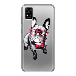 Чохол (ТПУ) Милі песики для ZTE Blade A31 (Бульдог в окулярах)