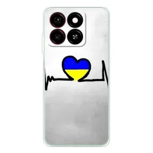 Силиконовый Чехол на ZTE Blade A35 (Я-Украина) (Украинская кардиограмма)