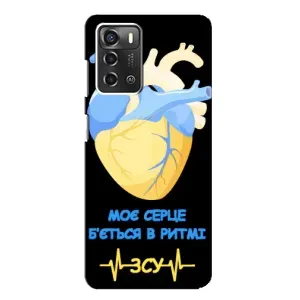 ЗСУ Чехлы (TPU) для ZTE Blade A52