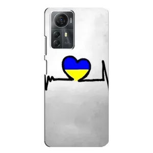 Силіконовий Чохол на ZTE Blade A72s (Я-Україна) (Українська кардіограма)