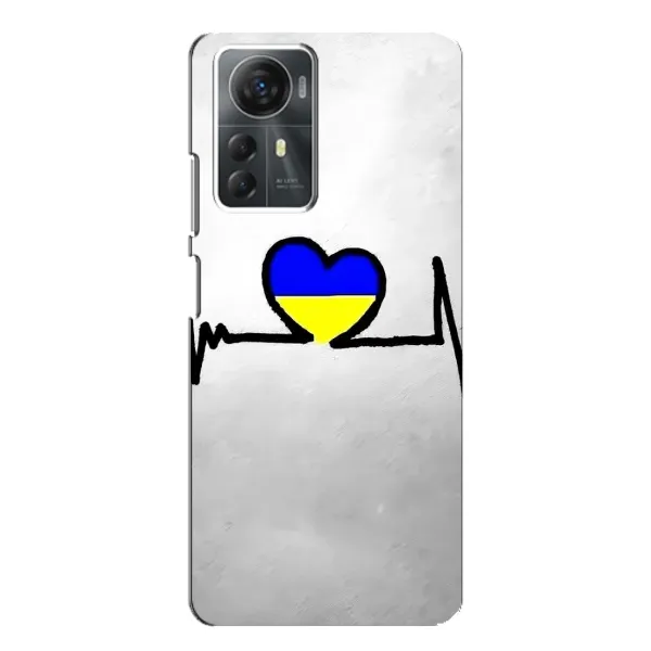 Чехол с рисунком «Украинская кардиограмма» для ZTE Blade A72s Чехол с рисунком «Украинская кардиограмма» для ZTE Blade A72s