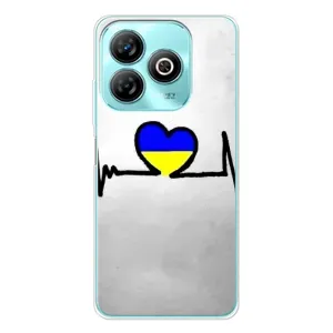 Силиконовый Чехол на ZTE Blade A75 (Я-Украина) (Украинская кардиограмма)