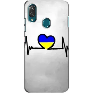 Силиконовый Чехол на ZTE Blade V10 Vita (Я-Украина) (Украинская кардиограмма)