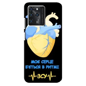 ЗСУ Чохли (TPU) для ZTE Blade V30
