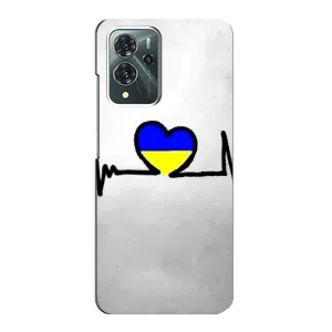 Силиконовый Чехол на ZTE Blade V40 Pro (Я-Украина) (Украинская кардиограмма)