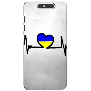 Силиконовый Чехол на ZTE Blade V8 (Я-Украина) (Украинская кардиограмма)