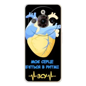 ЗСУ Чехлы (TPU) для ZTE Nubia Focus Pro (Ритм ЗСУ)