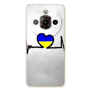 Силиконовый Чехол на ZTE Nubia Focus Pro (Я-Украина) (Украинская кардиограмма)
