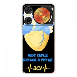 ЗСУ Чехлы (TPU) для ZTE Nubia Music 2 (Ритм ЗСУ)
