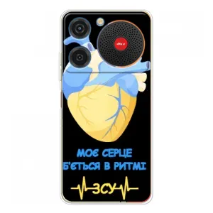 ЗСУ Чехлы (TPU) для ZTE Nubia Music (Ритм ЗСУ)