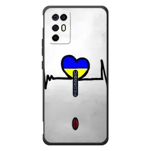 Силиконовый Чехол на ZTE Nubia RedMagic 6R (Я-Украина) (Украинская кардиограмма)