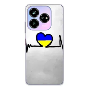 Силиконовый Чехол на ZTE Nubia V60 Design (Я-Украина) (Украинская кардиограмма)