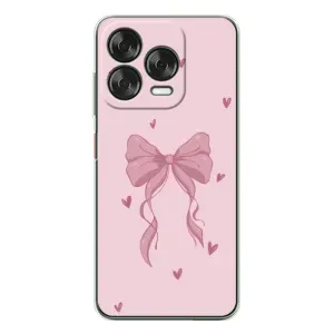Чехол банты для ZTE Nubia V70 Design (Бант на розовом)