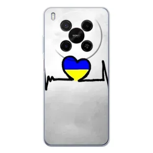 Силиконовый Чехол на ZTE Nubia V70 Max (Я-Украина) (Украинская кардиограмма)