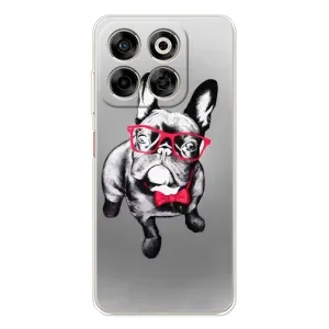 Чехол (ТПУ) Милые собачки для ZTE Nubia V70 (Бульдог в очках)
