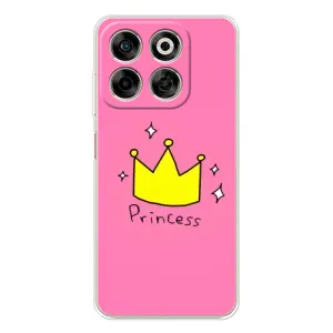 Девчачий Чехол для ZTE Nubia V70 (Princess)