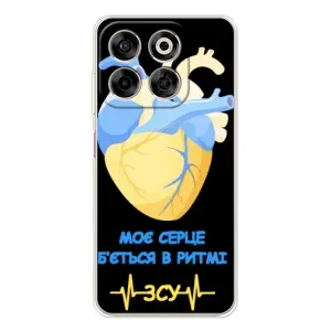 ЗСУ Чехлы (TPU) для ZTE Nubia V70 (Ритм ЗСУ)