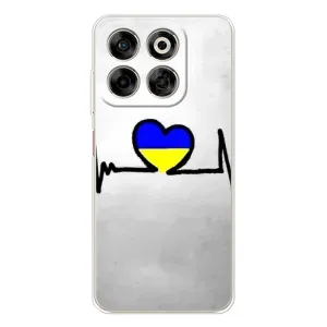 Силиконовый Чехол на ZTE Nubia V70 (Я-Украина) (Украинская кардиограмма)