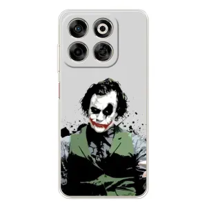 Чехлы с картинкой Джокера на ZTE Nubia V70 (Взгляд Джокера)