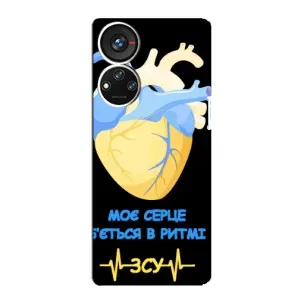 ЗСУ Чехлы (TPU) для ZTE Blade V40s (Ритм ЗСУ)
