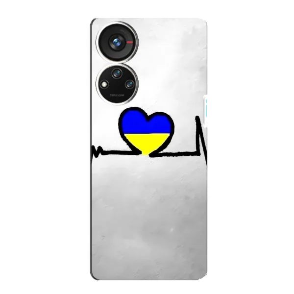 Чехол с рисунком «Украинская кардиограмма» для ZTE Blade V40s Чехол с рисунком «Украинская кардиограмма» для ZTE Blade V40s